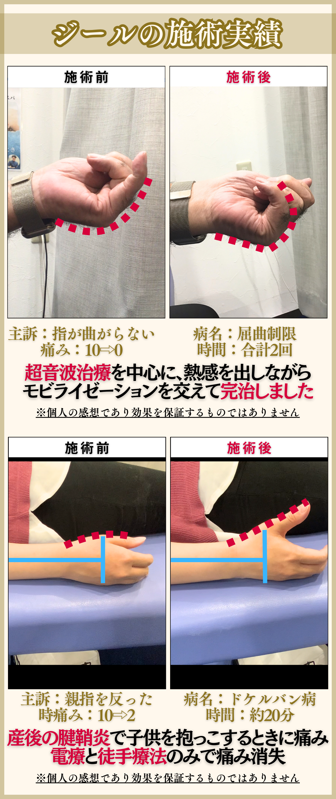 岡山市南区・中区ジール鍼灸整骨院の施術技術