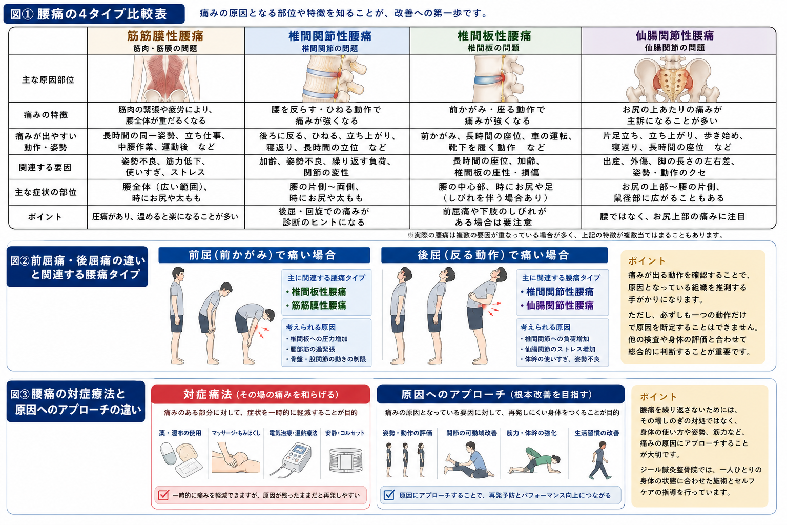 岡山市中区・南区｜腰痛の４タイプ比較