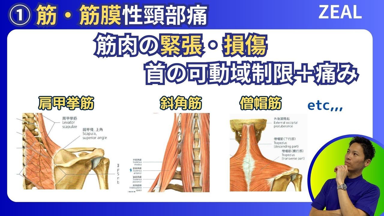 筋筋膜性頚部痛|岡山市南区・中区ジール鍼灸整骨院