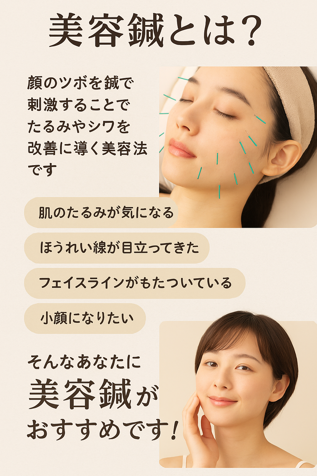 岡山市南区・中区ジール鍼灸整骨院｜美容鍼とは？