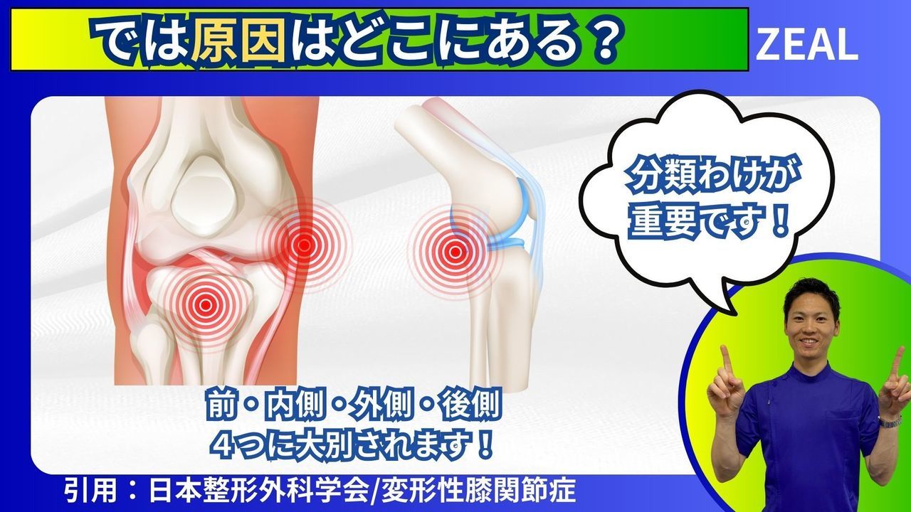 岡山市ジール整骨院|膝の痛みの原因