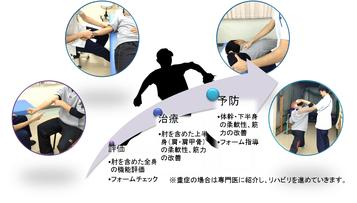 椎間孔障害の徒手検査|岡山市南区・中区ジール鍼灸整骨院