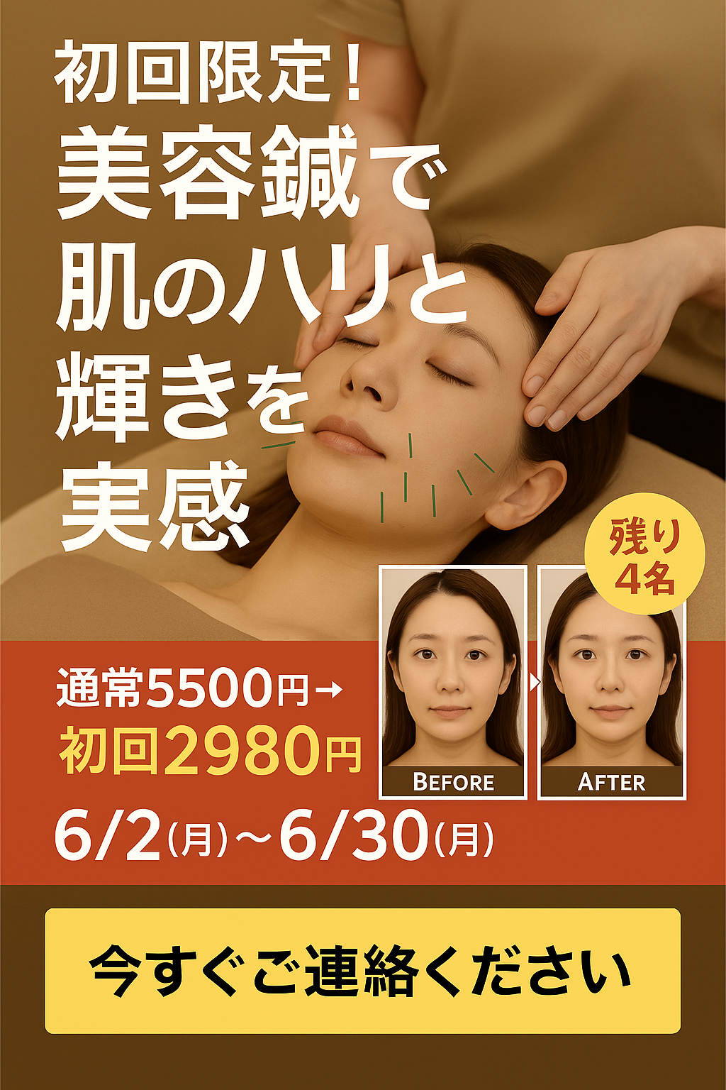 岡山市南区・中区ジール鍼灸整骨院｜まずは美容鍼をお試しください