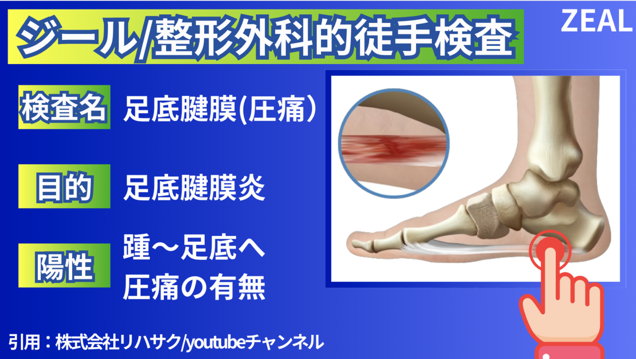 岡山市南区・中区ジール鍼灸整骨院|足底腱膜炎と徒手検査