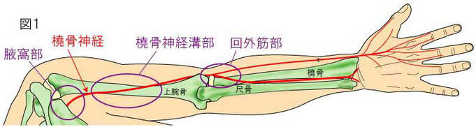 橈骨神経障害の領域｜岡山市ジール鍼灸整骨院