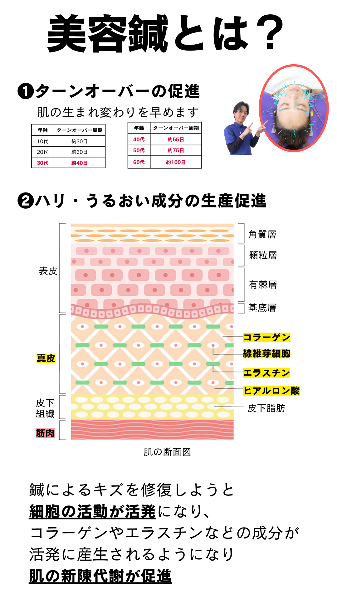岡山市南区・中区ジール鍼灸整骨院｜美容鍼とは？