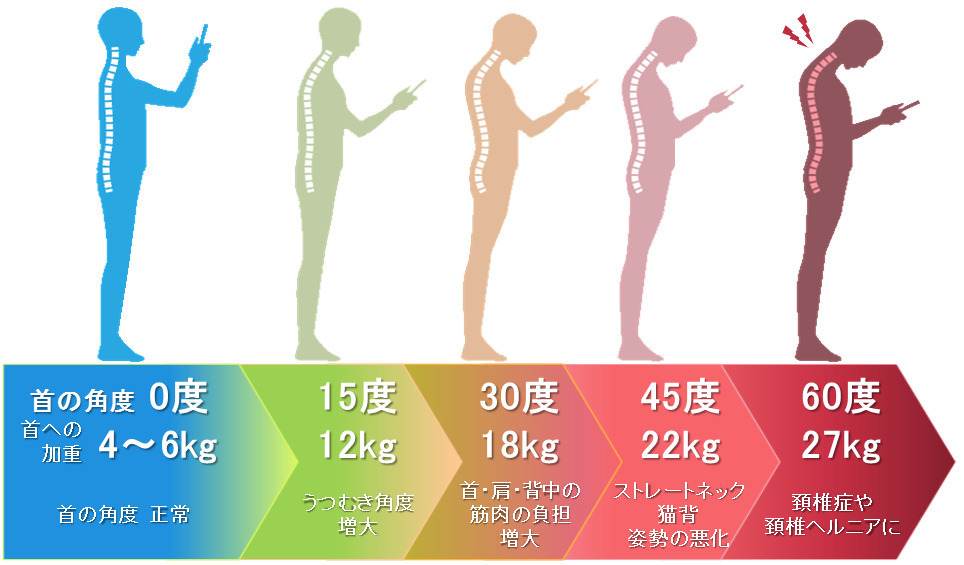 ストレートネックの頸部の角度｜岡山市ジール鍼灸整骨院