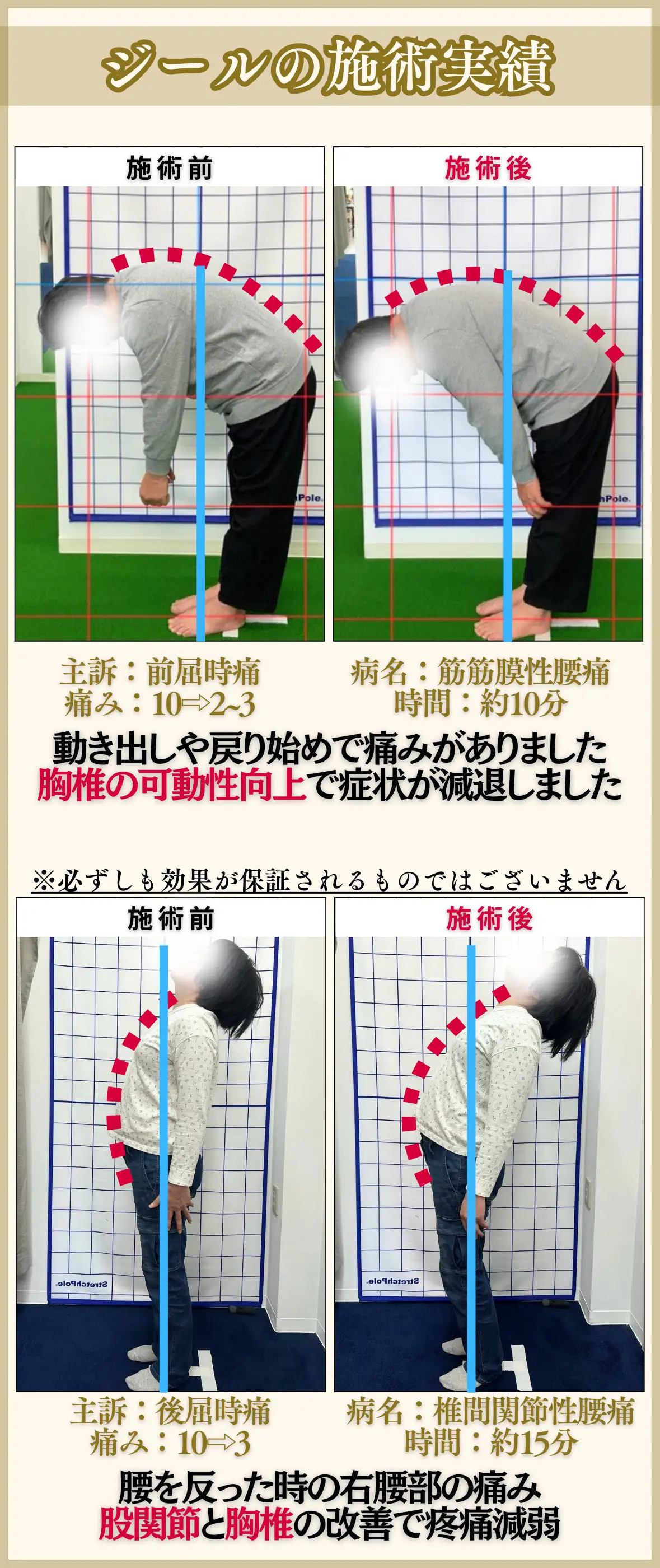 岡山市南区、中区ジール整骨院の施術実績