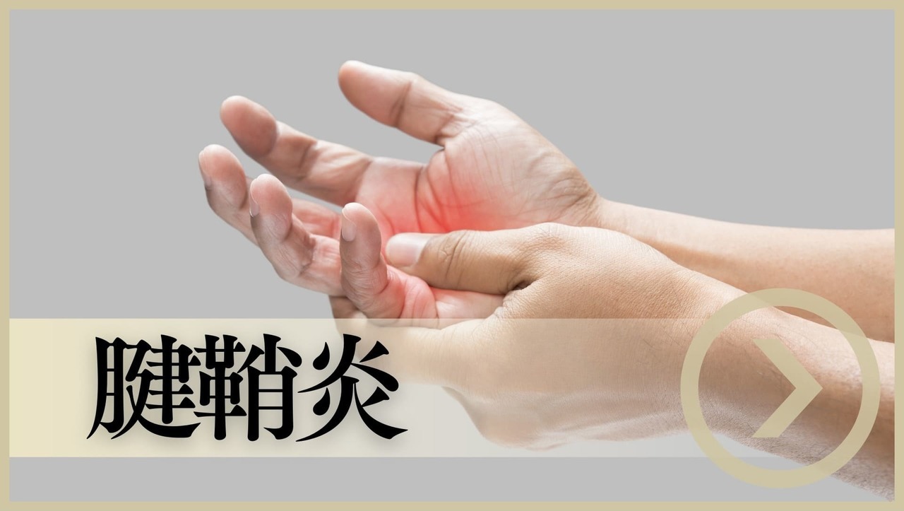 腱鞘炎｜岡山市南区・中区ジール鍼灸整骨院グループ