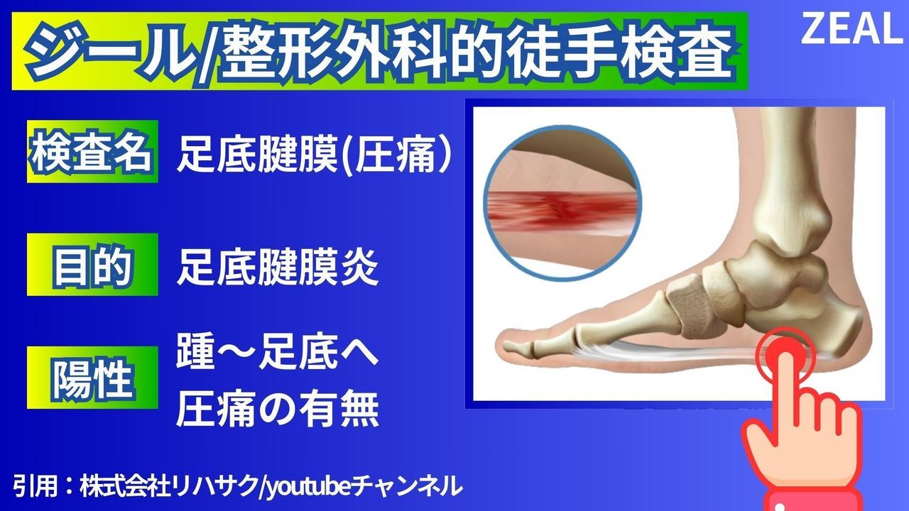 岡山市ジール整骨院|足底腱膜炎の検査