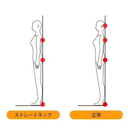 ストレートネックの特徴｜岡山市ジール鍼灸整骨院