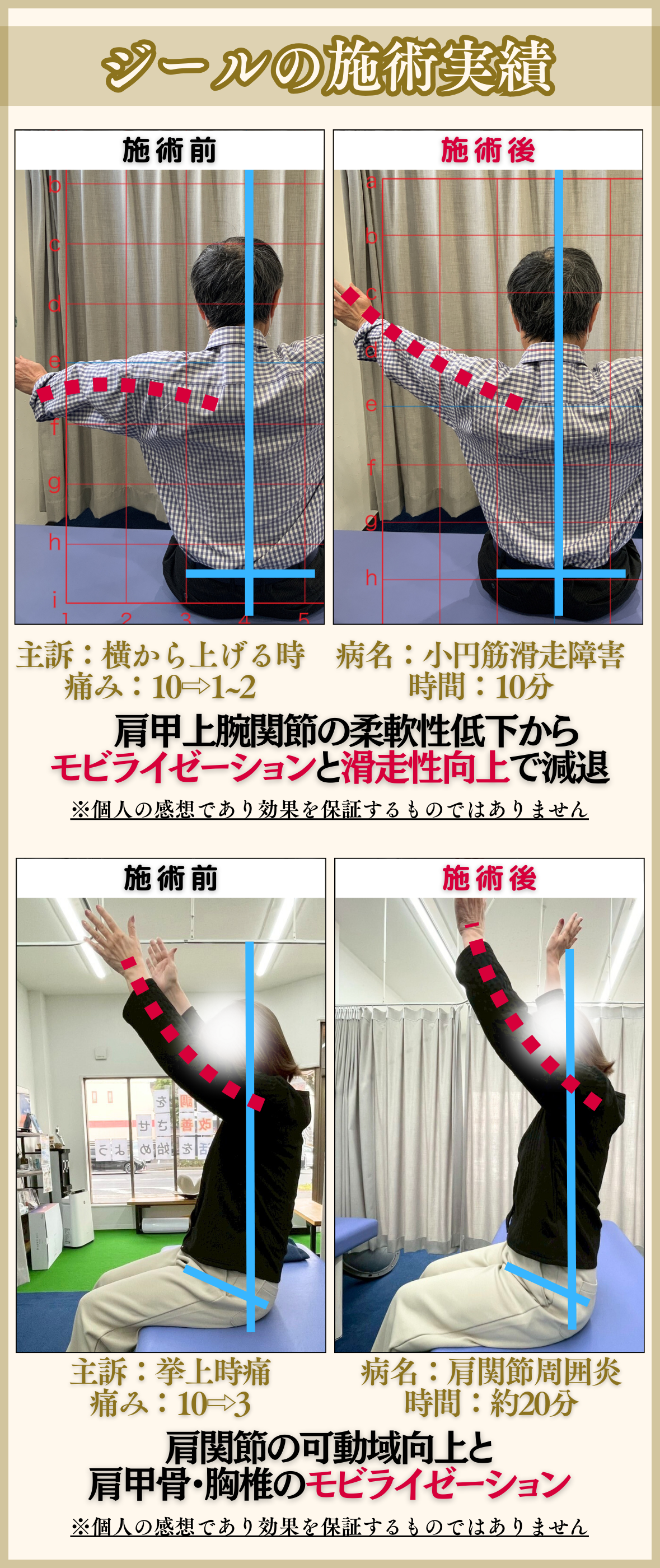 ジールの独自技術|岡山市南区・中区ジール鍼灸整骨院