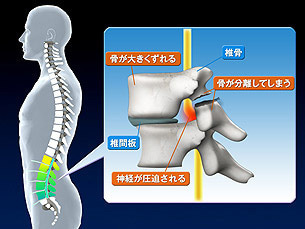 岡山市南区、中区ジール整骨院の独自技術